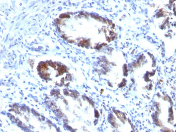 Transgelin (SM22-alpha) Antibody - With BSA and Azide