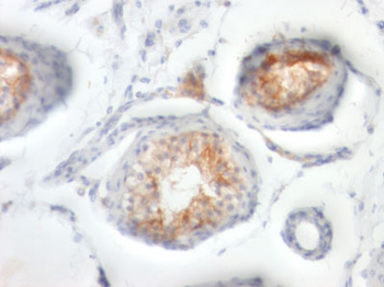 CD147 / EMMPRIN / Neurothelin Antibody - With BSA and Azide