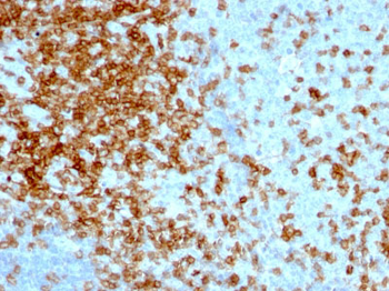 CD43 (T-Cell Marker) Antibody - With BSA and Azide