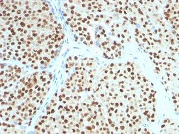 SOX10 (Melanoma Marker) Antibody - With BSA and Azide