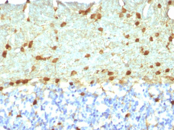 Fascin-1 (Reed-Sternberg Cell Marker) Antibody - With BSA and Azide