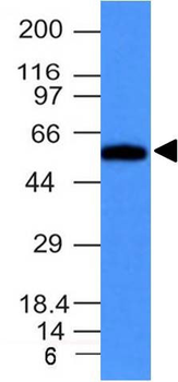 Fascin-1 (Reed-Sternberg Cell Marker) Antibody - With BSA and Azide