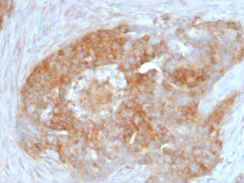Fascin-1 (Reed-Sternberg Cell Marker) Antibody - With BSA and Azide