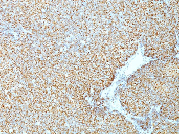 Cyclin D1 (G1-Cyclin & Mantle Cell Marker) Antibody - With BSA and Azide