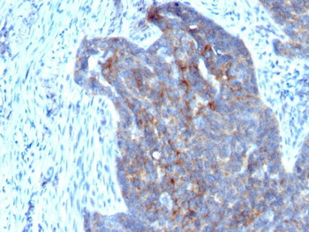 Retinol Binding Protein-1 (RBP1) Antibody - With BSA and Azide
