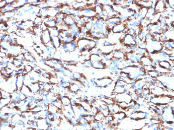 Actin, Smooth Muscle (Leiomyosarcoma Marker) Antibody - With BSA and Azide