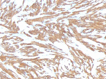 Actin, Smooth Muscle (Leiomyosarcoma Marker) Antibody - With BSA and Azide