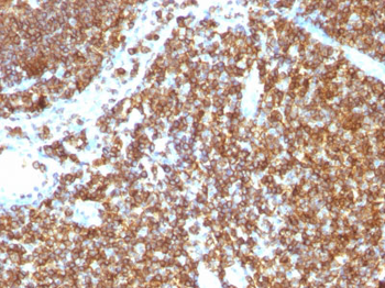 CD45RB (B-Cell Marker) Antibody - With BSA and Azide