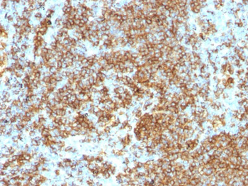 CD45RB (B-Cell Marker) Antibody - With BSA and Azide