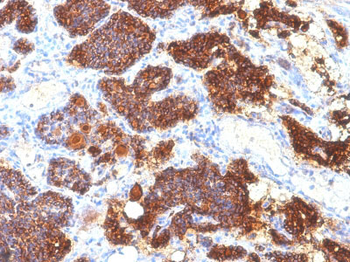 Parathyroid Hormone (PTH) (C-Terminal) Antibody - With BSA and Azide