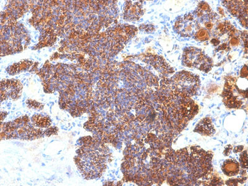 Parathyroid Hormone (PTH) (C-Terminal) Antibody - With BSA and Azide
