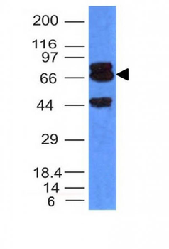 PTEN (Tumor Suppressor Protein) Antibody - With BSA and Azide
