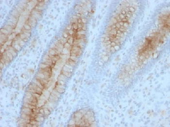Beta-2 Microglobulin (Renal Failure & Tumor Marker) Antibody - With BSA and Azide