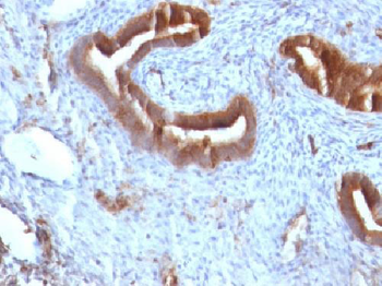 Beta-2 Microglobulin (Renal Failure & Tumor Marker) Antibody - With BSA and Azide