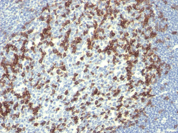 PD1 / PDCD1 / CD279 (Programmed Cell Death 1) Antibody - With BSA and Azide