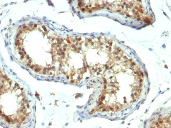 PAX7 (Rhabdomyosarcoma Marker) Antibody - With BSA and Azide