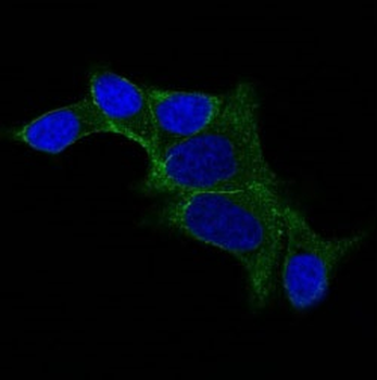 Ornithine Decarboxylase-1 (ODC-1) Antibody - With BSA and Azide