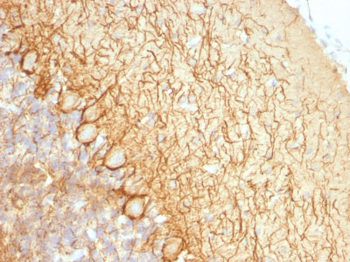 Neurofilament (NF-L) (Neuronal Marker) Antibody - With BSA and Azide