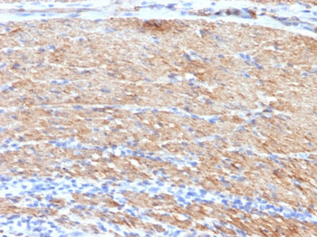 Smooth Muscle Myosin Heavy Chain (SM-MHC) (Leiomyosarcoma & Myoepithelial Cell Marker) Antibody - W