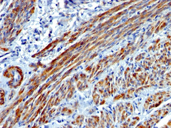 Smooth Muscle Myosin Heavy Chain (SM-MHC) (Leiomyosarcoma & Myoepithelial Cell Marker) Antibody - W