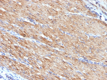 Smooth Muscle Myosin Heavy Chain (SM-MHC) (Leiomyosarcoma & Myoepithelial Cell Marker) Antibody - W