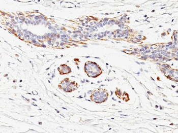 Smooth Muscle Myosin Heavy Chain (SM-MHC) (Leiomyosarcoma & Myoepithelial Cell Marker) Antibody - W