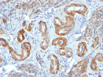 Smooth Muscle Myosin Heavy Chain (SM-MHC) (Leiomyosarcoma & Myoepithelial Cell Marker) Antibody - W