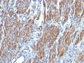 Smooth Muscle Myosin Heavy Chain (SM-MHC) (Leiomyosarcoma & Myoepithelial Cell Marker) Antibody - W