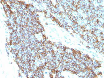 CD99 / MIC2 (Ewing's Sarcoma Marker) Antibody - Culture Supernatant