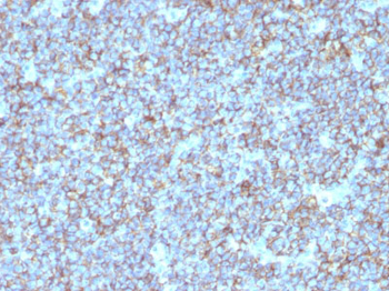 CD99 / MIC2 (Ewing's Sarcoma Marker) Antibody - With BSA and Azide