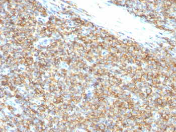CD99 / MIC2 (Ewings Sarcoma Marker) Antibody - Culture Supernatant