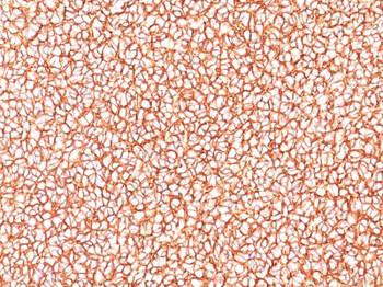 CD99 / MIC2 (Ewing's Sarcoma Marker) Antibody - With BSA and Azide