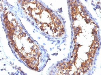 CD99 / MIC2 (Ewing's Sarcoma Marker) Antibody - With BSA and Azide
