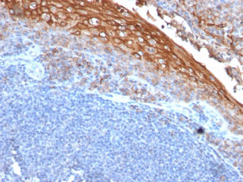 MUC18 / CD146 / MCAM (Melanoma Cell Adhesion Molecule) Antibody - With BSA and Azide