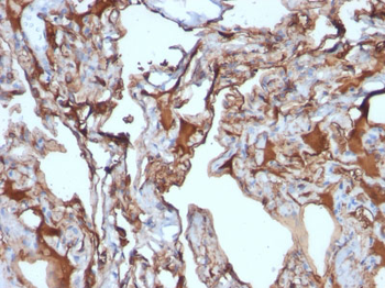 MUC18 / CD146 / MCAM (Melanoma Cell Adhesion Molecule) Antibody - With BSA and Azide