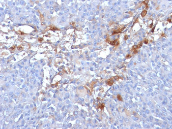 MUC18 / CD146 / MCAM (Melanoma Cell Adhesion Molecule) Antibody - With BSA and Azide