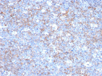 MUC18 / CD146 / MCAM (Melanoma Cell Adhesion Molecule) Antibody - With BSA and Azide