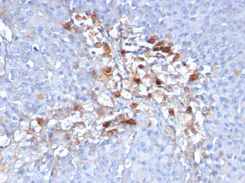 MUC18 / CD146 / MCAM (Melanoma Cell Adhesion Molecule) Antibody - With BSA and Azide