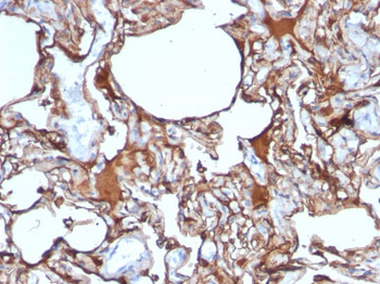 MUC18 / CD146 / MCAM (Melanoma Cell Adhesion Molecule) Antibody - With BSA and Azide