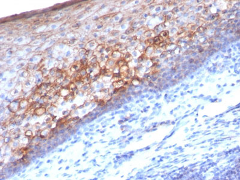 MUC18 / CD146 / MCAM (Melanoma Cell Adhesion Molecule) Antibody - With BSA and Azide