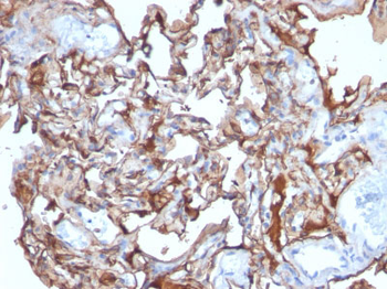 MUC18 / CD146 / MCAM (Melanoma Cell Adhesion Molecule) Antibody - With BSA and Azide