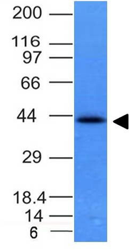 Ep-CAM / CD326 (Epithelial Marker) Antibody - With BSA and Azide