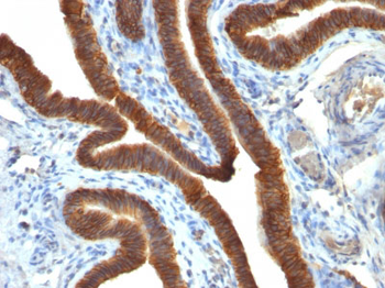Ep-CAM / CD326 (Epithelial Marker) Antibody - With BSA and Azide