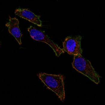 Ep-CAM / CD326 (Epithelial Marker) Antibody - With BSA and Azide