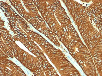 Ep-CAM / CD326 (Epithelial Marker) Antibody - With BSA and Azide