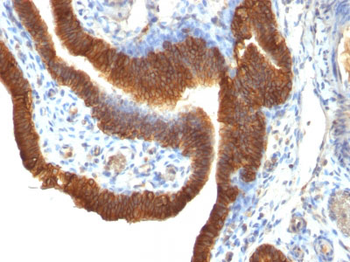Ep-CAM / CD326 (Epithelial Marker) Antibody - With BSA and Azide