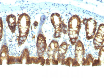 Ep-CAM / CD326 (Epithelial Marker) Antibody - With BSA and Azide