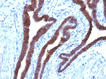 Ep-CAM / CD326 (Epithelial Marker) Antibody - With BSA and Azide
