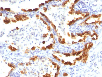 Cytokeratin 18 (KRT18) Antibody - With BSA and Azide
