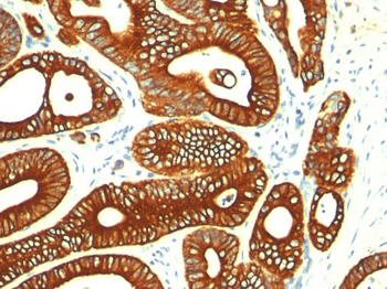 Cytokeratin 18 (KRT18) Antibody - With BSA and Azide